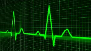 andamento del battito cardiaco