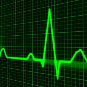 andamento del battito cardiaco